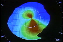 topografia_corneal_2